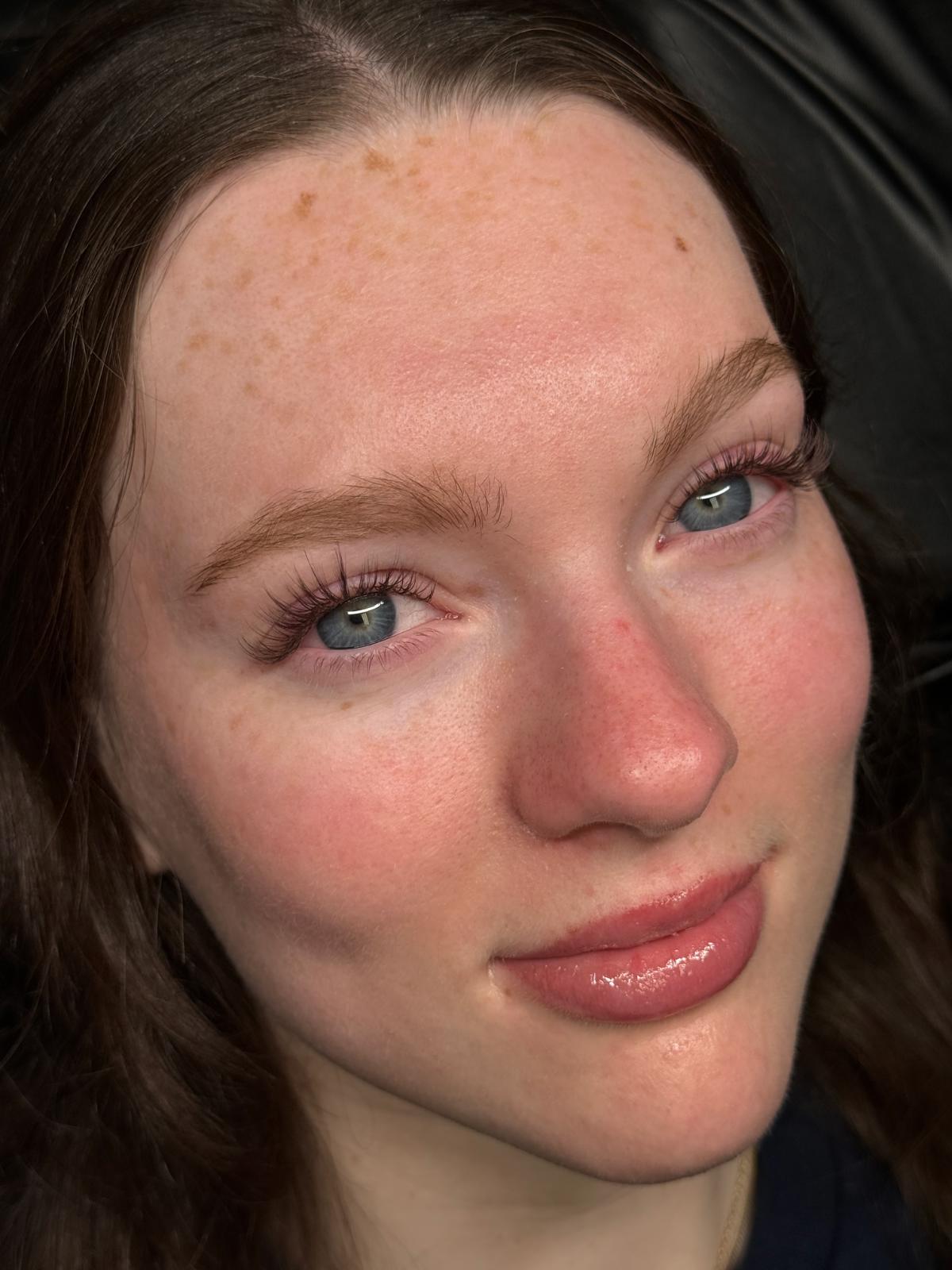unnamed image